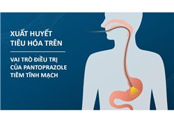 Xuất huyết tiêu hóa trên - Vai trò điều trị của pantoprazole tiêm tĩnh mạch